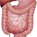 Unerwünschte Arzneimittelwirkungen: Ileus unter Psychopharmaka
