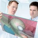 Therapieoptionen bei fortgeschrittenem Morbus Parkinson