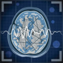 Management therapierefraktärer Epilepsien
