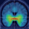 Testosteron erhöht die Serotonin & transporterbindung im Gehirn