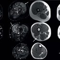 Der Stellenwert von Ultraschall, CT und MRT