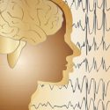 DFP: Neu auftretende Epilepsie