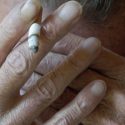 Risikofaktor Rauchen in der Psychiatrie