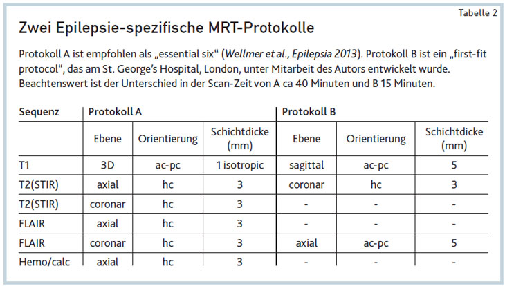 Dfp Neu Auftretende Epilepsie Ogpb