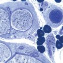 Der Stellenwert der Biopsiediagnostik