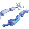 Genetische und immunmediierte Neuropathien