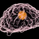 Neurokognition und Quality of Life